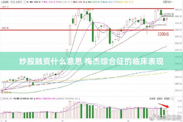 炒股融资什么意思 梅杰综合征的临床表现